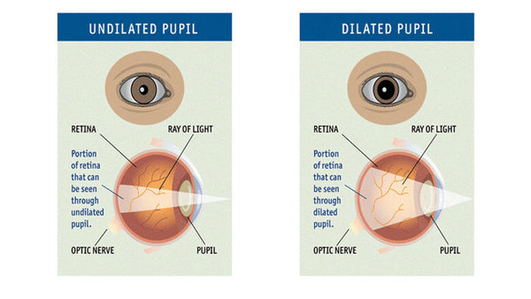 Atropt (Atropine) 1% Eye Drop 5ml bottle.