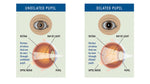 Atropt (Atropine) 1% Eye Drop 5ml bottle.
