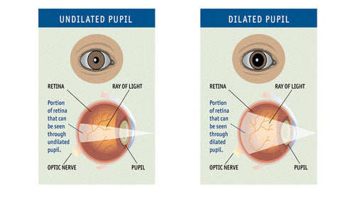 Atropt (Atropine) 1% Eye Drop 5ml bottle